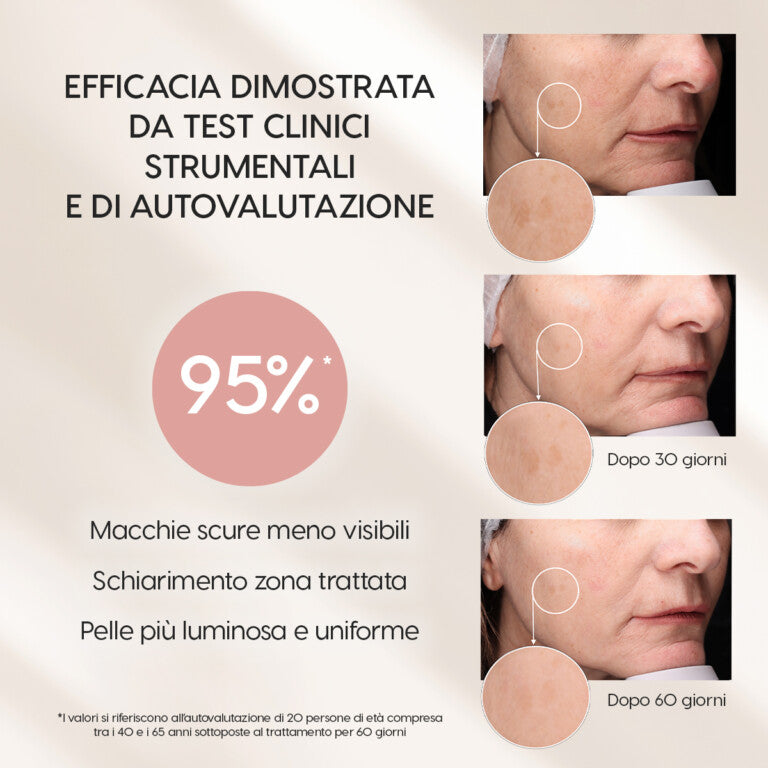 Dark Spot Remedy   Anti-Pigmentflecken Serum mit Bärentrauben und Olivenblattextrakt  30ml